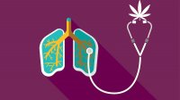 CBD és a krónikus obstruktív tüdőbetegség (COPD)
