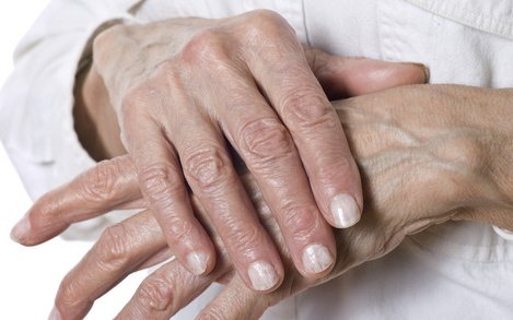Rheumatoid Arthritis - Bács-Kiskun Megyei Kórház